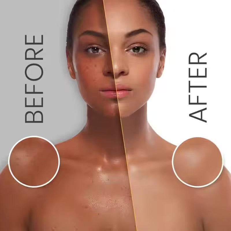 10% Niacinamide , 4% Tranexamic Acid, Alpha Arbutin Triple Brightening Intensive Serum